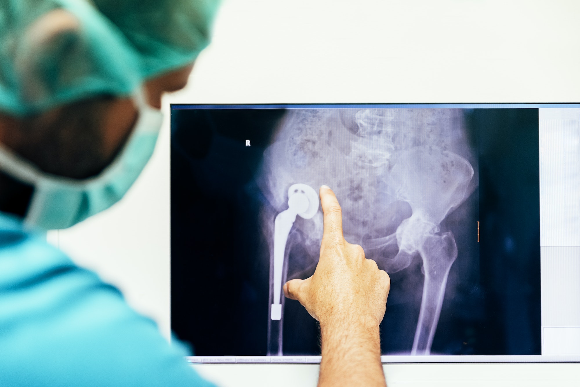 Medicine doctor looking x-ray image. Medicine doctor looking x-ray image.